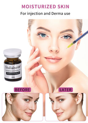 कॉस्मेटिक सौंदर्य 5ml एंटी एजिंग Microneedling Hyaluronic एसिड इंजेक्शन भराव इंजेक्शन
