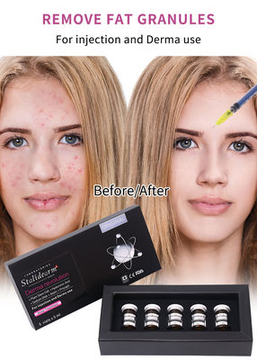 Stalidearm Dermal Fillers Acne Treatment Acne Healing and Blemish Reduction के लिए इंजेक्शन सीरम
